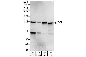Western Blotting (WB) image for anti-ATP Citrate Lyase (ACLY) (AA 1051-1101) antibody (ABIN7452922) (ACLY anticorps  (AA 1051-1101))