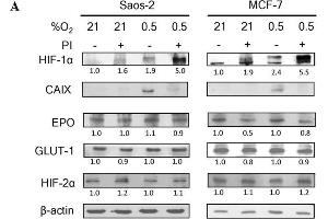 Bortezomib attenuates HIF-1 but not HIF-2 transcriptional activity. (EPAS1 anticorps)