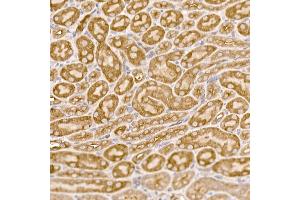 Immunohistochemistry of paraffin-embedded mouse kidney using NUMB Rabbit pAb (ABIN6129424, ABIN6144943, ABIN6144944 and ABIN6224990) at dilution of 1:250 (40x lens).