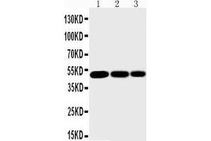 Anti-IKK gamma antibody, Western blotting Lane 1: Mouse Liver Tissue Lysate Lane 2: Mouse Brain Tissue Lysate Lane 3: Mouse Ovary Tissue Lysate