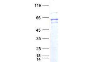 Validation with Western Blot