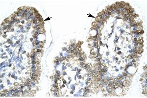 Rabbit Anti-MYCBP Antibody Catalog Number: ARP31860 Paraffin Embedded Tissue: Human Intestine Cellular Data: Epithelial cells of intestinal villas Antibody Concentration: 4.