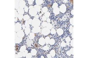 Immunohistochemical staining of human bone marrow with TAGLN2 polyclonal antibody  shows cytoplasmic positivity in bone marrow poietic cells at 1:200-1:500 dilution.