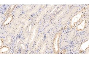 Detection of MIg in Human Kidney Tissue using Monoclonal Antibody to Monokine Induced By Interferon Gamma (MIg)