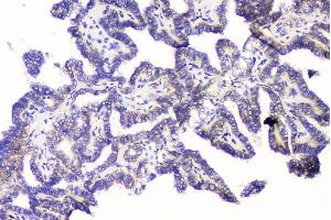IHC analysis of RRBP1 using anti-RRBP1 antibody (ABIN6719628).