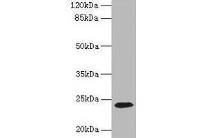 Western blot All lanes: CD3E antibody at 1. (CD3 epsilon anticorps  (AA 23-207))