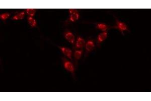 ABIN6277528 staining 293 by IF/ICC. (Ephrin A1 anticorps  (Internal Region))