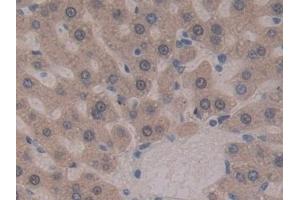 Detection of GSTt2 in Rat Liver Tissue using Polyclonal Antibody to Glutathione S Transferase Theta 2 (GSTt2)