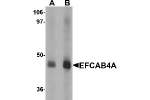 Western blot analysis of EFCAB4A in human lung tissue lysate with EFCAB4A antibody at (A) 1 and (B) 2 µg/mL. (EFCAB4A anticorps  (Middle Region))