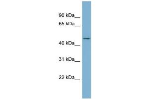 WB Suggested Anti-ENOSF1  Antibody Titration: 0. (ENOSF1 anticorps  (N-Term))
