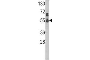 Western blot analysis of IL17RB antibody and MDA-MB468 lysate. (IL17 Receptor B anticorps  (AA 207-234))