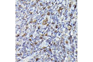 Immunohistochemistry of paraffin-embedded human tonsil using Smad2 Rabbit pAb (ABIN1513537, ABIN3020986, ABIN3020987 and ABIN1514681) at dilution of 1:100 (40x lens). (SMAD2 anticorps)