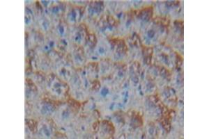 IHC-P analysis of Liver tissue, with DAB staining. (CD40 Ligand anticorps  (AA 180-261))
