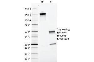 SDS-PAGE Analysis Purified EpCAM-Monospecific Mouse Monoclonal Antibody (EGP40/1372). (EpCAM anticorps  (Extracellular Domain))