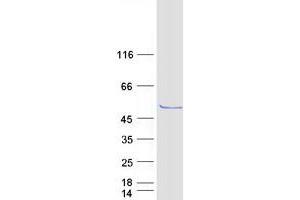 Validation with Western Blot