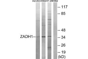 Western blot analysis of extracts from HUVEC cells, K562 cells and HT-29 cells, using ZADH1 antibody. (PTGR2 anticorps  (Internal Region))