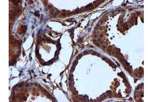 Immunohistochemical staining of paraffin-embedded Human breast tissue using anti-CYB5R3 mouse monoclonal antibody.