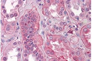 Human Kidney: Formalin-Fixed, Paraffin-Embedded (FFPE)