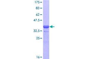 Image no. 1 for GATA Binding Protein 4 (GATA4) (AA 343-442) protein (GST tag) (ABIN1354839)