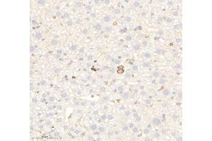Immunohistochemistry of paraffin embedded mouse liver using RAB21 (ABIN7075341) at dilution of 1: 700 (300x lens)