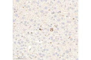 Immunohistochemistry of paraffin embedded mouse liver using RAB21 (ABIN7075341) at dilution of 1: 700 (300x lens) (RAB21 anticorps)