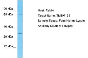 Host: Rabbit Target Name: TMEM169 Sample Type: Fetal Kidney lysates Antibody Dilution: 1. (TMEM169 anticorps  (C-Term))