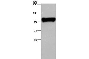 Western Blot analysis of Raji cell using PTK2B Polyclonal Antibody at dilution of 1:300