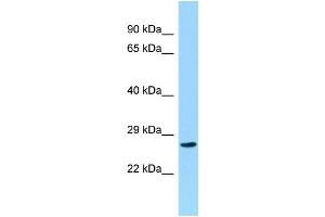 Host: Rabbit Target Name: CCDC28B Sample Type: Hela Whole cell lysates Antibody Dilution: 1. (CCDC28B anticorps  (C-Term))