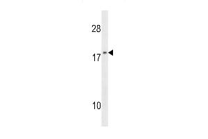 NME1 Antibody (F40) (ABIN392655 and ABIN2842156) western blot analysis in 293 cell line lysates (35 μg/lane). (NME1 anticorps  (N-Term))