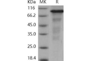 Western Blotting (WB) image for Endoplasmic Reticulum To Nucleus Signaling 1 (ERN1) (AA 465-977) (Active) protein (GST tag,His tag) (ABIN7317060)