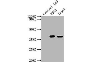Immunoprecipitating CDK6 in K562 whole cell lysate Lane 1: Rabbit control IgG instead of ABIN7127420 in K562 whole cell lysate.