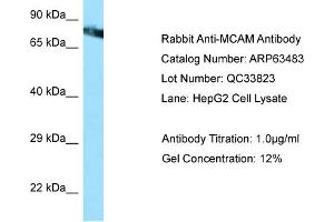 Western Blotting (WB) image for anti-Melanoma Cell Adhesion Molecule (MCAM) (Middle Region) antibody (ABIN2789518) (MCAM anticorps  (Middle Region))