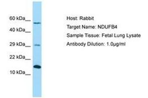 Image no. 1 for anti-NADH Dehydrogenase (Ubiquinone) 1 beta Subcomplex, 4, 15kDa (NDUFB4) (AA 71-120) antibody (ABIN6750060) (NDUFB4 anticorps  (AA 71-120))