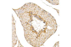 Immunohistochemistry of paraffin-embedded human liver using CD81 Rabbit pAb (ABIN6134776, ABIN6138231, ABIN6138232 and ABIN6220897) at dilution of 1:50 (40x lens). (CD81 anticorps  (AA 1-100))