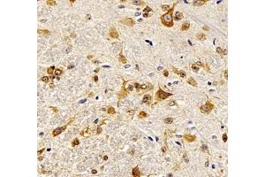 Immunohistochemistry of paraffin embedded rat spinal cord using NACAD (ABIN7074756) at dilution of 1:1000 (400x lens) (NACAD anticorps)