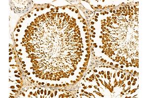 ABIN6261249 and ABIN6268912 at 1/100 staining Rat testis tissue by IHC-P. (DDR1 anticorps  (C-Term))