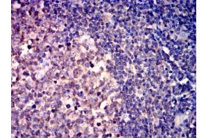 Immunohistochemical analysis of paraffin-embedded lymphoid tissues using CD267 mouse mAb with DAB staining. (TACI anticorps)