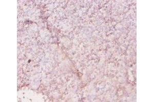 Immunohistochemistry of paraffin-embedded human tonsil tissue using ABIN7155601 at dilution of 1:20 (HLA-DRA anticorps  (AA 28-254))