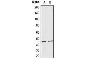 Western blot analysis of Cytokeratin 18 (pS33) expression in A431 (A), HeLa (B) whole cell lysates.