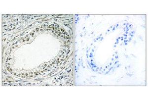 Immunohistochemistry (IHC) image for anti-Ribosomal Protein L36 (RPL36) (Internal Region) antibody (ABIN1850636) (RPL36 anticorps  (Internal Region))