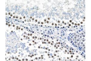 Phospho-JIP1 (Thr205) Antibody at 1/100 staining Rat testis tissue by IHC-P. (MAPK8IP1 anticorps  (pThr205))