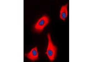 Immunofluorescent analysis of PTHR1 staining in HEK293T cells. (PTH1R anticorps  (Center))