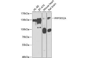 Western blot analysis of extracts of various cell lines, using PPP1R12A antibody (ABIN6128261, ABIN6146060, ABIN6146062 and ABIN6222412) at 1:1000 dilution. (PPP1R12A anticorps  (AA 710-970))