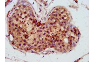 IHC image of ABIN7173941 diluted at 1:800 and staining in paraffin-embedded human testis tissue performed on a Leica BondTM system. (C10orf2 anticorps  (AA 559-684))