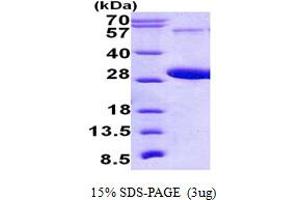 SDS-PAGE (SDS) image for RAB5C, Member RAS Oncogene Family (Rab5c) (AA 1-216) protein (His tag) (ABIN5852923) (Rab5c Protein (AA 1-216) (His tag))