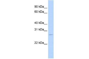 WB Suggested Anti-RBM38 Antibody Titration:  0. (RBM38 anticorps  (N-Term))