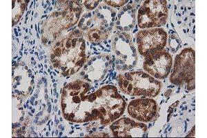 Immunohistochemical staining of paraffin-embedded Human Kidney tissue using anti-GRHPR mouse monoclonal antibody. (GRHPR anticorps)