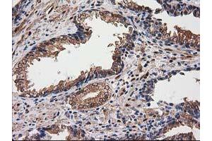 Image no. 6 for anti-Destrin (Actin Depolymerizing Factor) (DSTN) antibody (ABIN1497907)