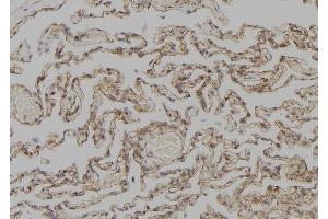 ABIN6277309 at 1/100 staining Human lung tissue by IHC-P.