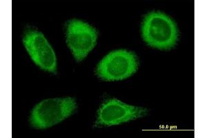 Immunofluorescence of purified MaxPab antibody to RPN2 on HeLa cell.